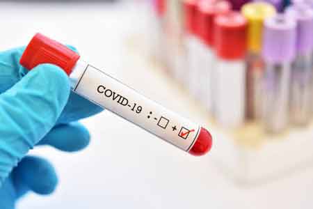 Diagnoses Coronavirus